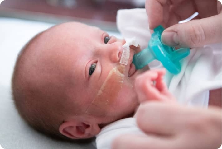 Solo práctica: Disfagia neonatal enfocada a UCIN y prematuridad